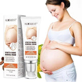 LOVEMI - Lovemi - Remove Pregnancy Scars Acne Cream Stretch Mark